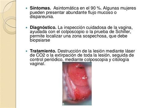 canas en la vagina|Llagas en genitales femeninos: Fotos, causas y .